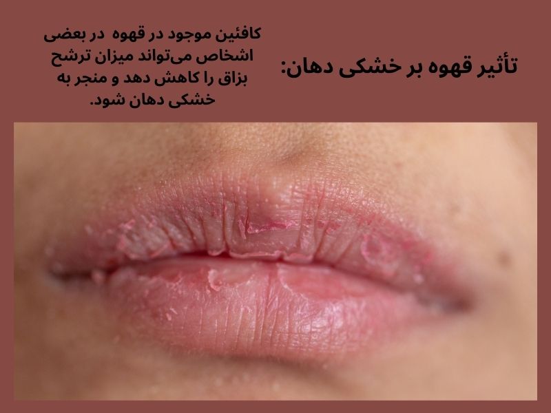تأثیر قهوه بر خشکی دهان